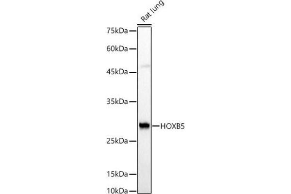 HOXB5 anticorps  (AA 1-170)