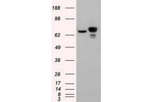 HEK293T cells were transfected with the pCMV6-ENTRY control (Left lane) or pCMV6-ENTRY CTNNB1 (RC208947) (Right lane) cDNA for 48 hrs and lysed. (CTNNB1 anticorps  (AA 531-781))