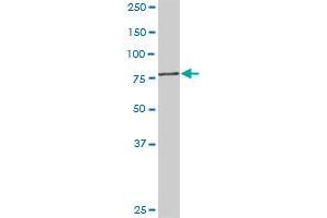 PFKM MaxPab rabbit polyclonal antibody.