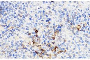 Immunohistochemistry of paraffin-embedded Rat spleen using YKL-40 / CHI3L1 Polyclonal Antibody at dilution of 1:100 (40x lens).