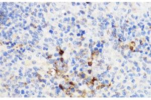 Immunohistochemistry of paraffin-embedded Rat spleen using YKL-40 / CHI3L1 Polyclonal Antibody at dilution of 1:100 (40x lens). (CHI3L1 anticorps)