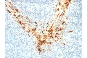 Formalin-fixed, paraffin-embedded human Tonsil stained with Mesothelin Mouse Monoclonal Antibody (MSLN/2131).