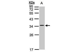 WB Image Sample(30 ug whole cell lysate) A:Hep G2 , 12% SDS PAGE antibody diluted at 1:1000 (CACNG5 anticorps  (Center))