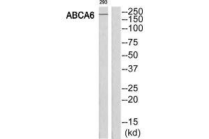 Western Blotting (WB) image for anti-ATP-Binding Cassette, Sub-Family A (ABC1), Member 6 (ABCA6) (C-Term) antibody (ABIN1850838) (ABCA6 anticorps  (C-Term))