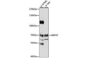 Western blot analysis of extracts of various cell lines, using GNPAT antibody (ABIN1872854) at 1:1000 dilution. (GNPAT anticorps)