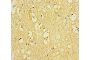 Immunohistochemistry of paraffin-embedded human brain tissue using ABIN7172313 at dilution of 1:100 (TOX3 anticorps  (AA 8-305))