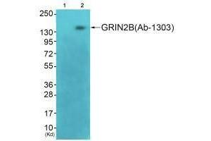 Western blot analysis of extracts from 3T3 cells (Lane 2), using GRIN2B (Ab-1303) antiobdy. (GRIN2B anticorps  (Ser1303))