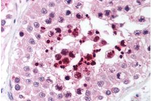 Human Testis (formalin-fixed, paraffin-embedded) stained with RIF1 antibody ABIN214034 at 5 ug/ml followed by biotinylated goat anti-rabbit IgG secondary antibody ABIN481713, alkaline phosphatase-streptavidin and chromogen. (RIF1 anticorps  (AA 2406-2419))