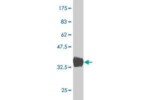 Western Blot detection against Immunogen (36. (BARX1 anticorps  (AA 1-100))
