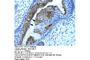 Human Spermatophore (HDAC2 anticorps  (C-Term))