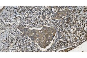 IHC analysis of MPI using anti-MPI antibody (ABIN7600514). (MPI anticorps  (AA 2-99))