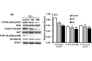 Qigesan inhibits PI3K/AKT and NF-κB signaling pathwayEca109 and TE1 cells were treated with QGS (0, 100, and 200 μg/mL) for 24 h. (AKT1 anticorps  (pThr308))