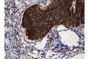 Image no. 9 for anti-SERPINE1 mRNA Binding Protein 1 (SERBP1) (AA 1-262) antibody (ABIN1490675)