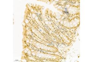 Immunohistochemistry of paraffin embedded mouse colon using PABPN1 (ABIN7075116) at dilution of 1:600 (400x lens) (PABPN1 anticorps)