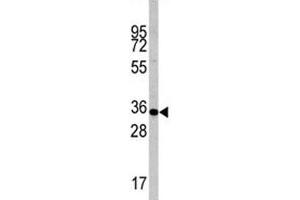 Western blot analysis of Caspase-6 antibody and mouse liver tissue lysate