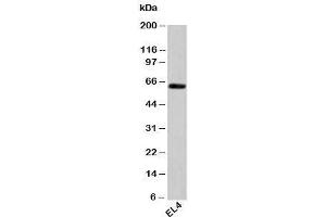 Western blot testing of mouse samples with HSP60 antibody at 1ug/ml. (HSPD1 anticorps)