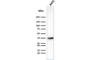 Western Blot Analysis of Human A431 cell lysate using GLUT-1 Mouse Monoclonal Antibody (GLUT1/2475).