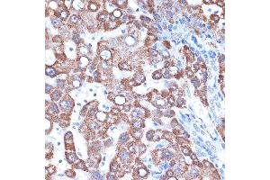 Immunohistochemistry of paraffin-embedded human liver using GOT2 Rabbit mAb (ABIN7267427) at dilution of 1:100 (40x lens).