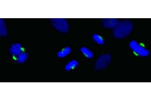 anti-Asp (Abnormal Spindle) Homolog, Microcephaly Associated (ASPM) (C-Term) antibody