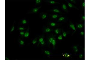 Immunofluorescence of monoclonal antibody to C1D on HeLa cell. (C1D anticorps  (AA 1-141))
