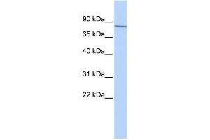 WB Suggested Anti-APP Antibody Titration: 0. (APP anticorps  (Middle Region))
