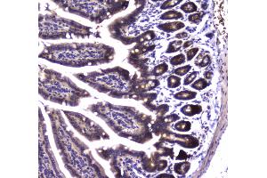 IHC analysis of SDHB using anti-SDHB antibody .