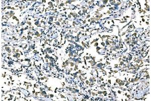 IHC analysis of B Raf/BRAF using anti-B Raf/BRAF antibody (ABIN3043761). (BRAF anticorps  (AA 38-230))