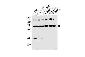 DLL3 anticorps  (C-Term)