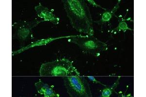 Immunofluorescence analysis of U-251MG cells using TREM2 Polyclonal Antibody at dilution of 1:100. (TREM2 anticorps)