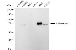 Western blotting analysis using caldesmon 1 antibody (ABIN7797840).
