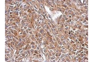 Image no. 1 for anti-3-Oxoacyl-ACP Synthase, Mitochondrial (OXSM) (AA 234-423) antibody (ABIN1501992)