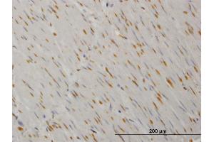 Immunoperoxidase of monoclonal antibody to YES1 on formalin-fixed paraffin-embedded human smooth muscle.