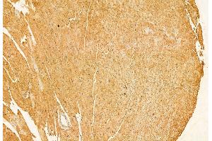 ABIN6264306 and ABIN6272878 at 1/100 staining Mouse heart tissue by IHC-P. (PLOD3 anticorps  (C-Term))