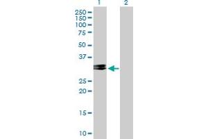 Western Blot analysis of CHMP2A expression in transfected 293T cell line by CHMP2A MaxPab polyclonal antibody. (CHMP2A anticorps  (AA 1-222))