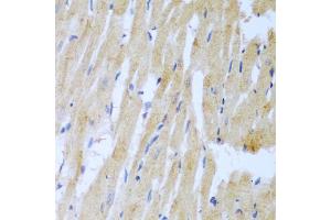 Immunohistochemistry of paraffin-embedded rat heart using UBE2L3 antibody (ABIN5972307) at dilution of 1/100 (40x lens). (UBE2L3 anticorps)