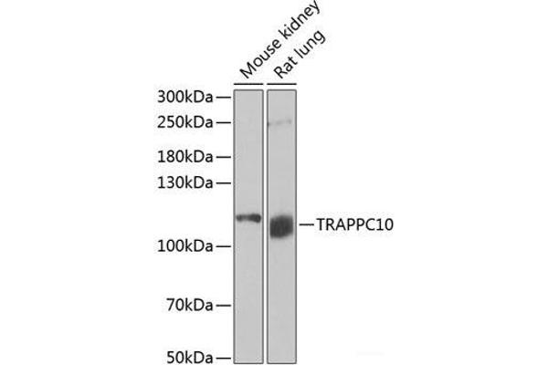TRAPPC10 anticorps