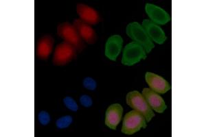 Phospho-CRTC3 (Ser162) Antibody staining Hela cells(45 min of heat-shock treatment) by IF/ICC.