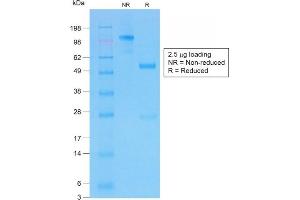 SDS-PAGE Analysis of Purifed CFTR Rabbit Recombinant Monoclonal Antibody (CFTR/1775R). (Recombinant CFTR anticorps  (AA 258-385))