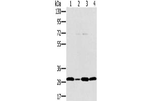 Gel: 8 % SDS-PAGE, Lysate: 40 μg, Lane 1-4: Jurkat cells, hela cells, 293T cells, human thyroid cancer tissue, Primary antibody: ABIN7130584(PEF1 Antibody) at dilution 1/200, Secondary antibody: Goat anti rabbit IgG at 1/8000 dilution, Exposure time: 20 seconds (PEF1 anticorps)