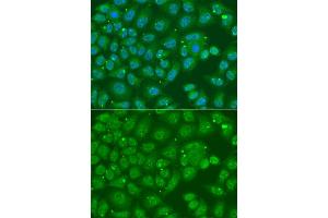 Immunofluorescence analysis of A549 cell using ANXA8L2 antibody. (ANXA8L2 anticorps)