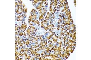 Immunohistochemistry of paraffin-embedded rat pancreas using eIF2A Rabbit mAb (ABIN7267035) at dilution of 1:100 (40x lens).