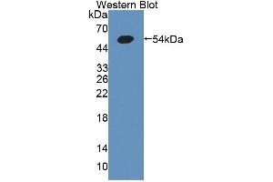 Figure. (GCK anticorps  (AA 194-410))