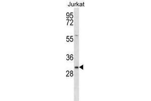 TMED8 Antibody (Center) western blot analysis in Jurkat cell line lysates (35 µg/lane).