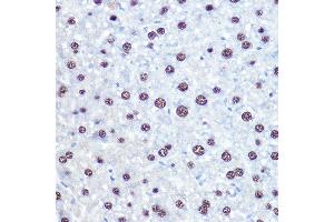 Immunohistochemistry of paraffin-embedded mouse liver using APIP Rabbit pAb (ABIN6131310, ABIN6136985, ABIN6136986 and ABIN6222909) at dilution of 1:100 (40x lens). (APIP anticorps  (AA 1-242))