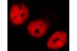 ABIN6267450 staining MCF7 by IF/ICC.