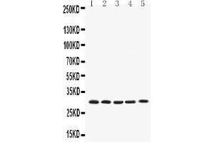 Western blot analysis of Bcl-XL using anti-Bcl-XL antibody .