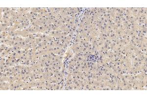 Detection of GPC3 in Human Liver Tissue using Monoclonal Antibody to Glypican 3 (GPC3) (Glypican 3 anticorps  (AA 343-559))