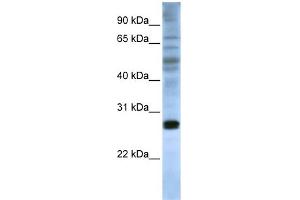 WB Suggested Anti-EIF4E Antibody Titration:  0. (EIF4E anticorps  (C-Term))