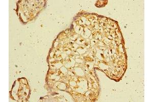 Immunohistochemistry of paraffin-embedded human placenta tissue using ABIN7175798 at dilution of 1:100 (WDR88 anticorps  (AA 1-250))