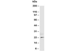 Western blot testing of NGF antibody and rat brain tissue lysate (Nerve Growth Factor anticorps  (N-Term))